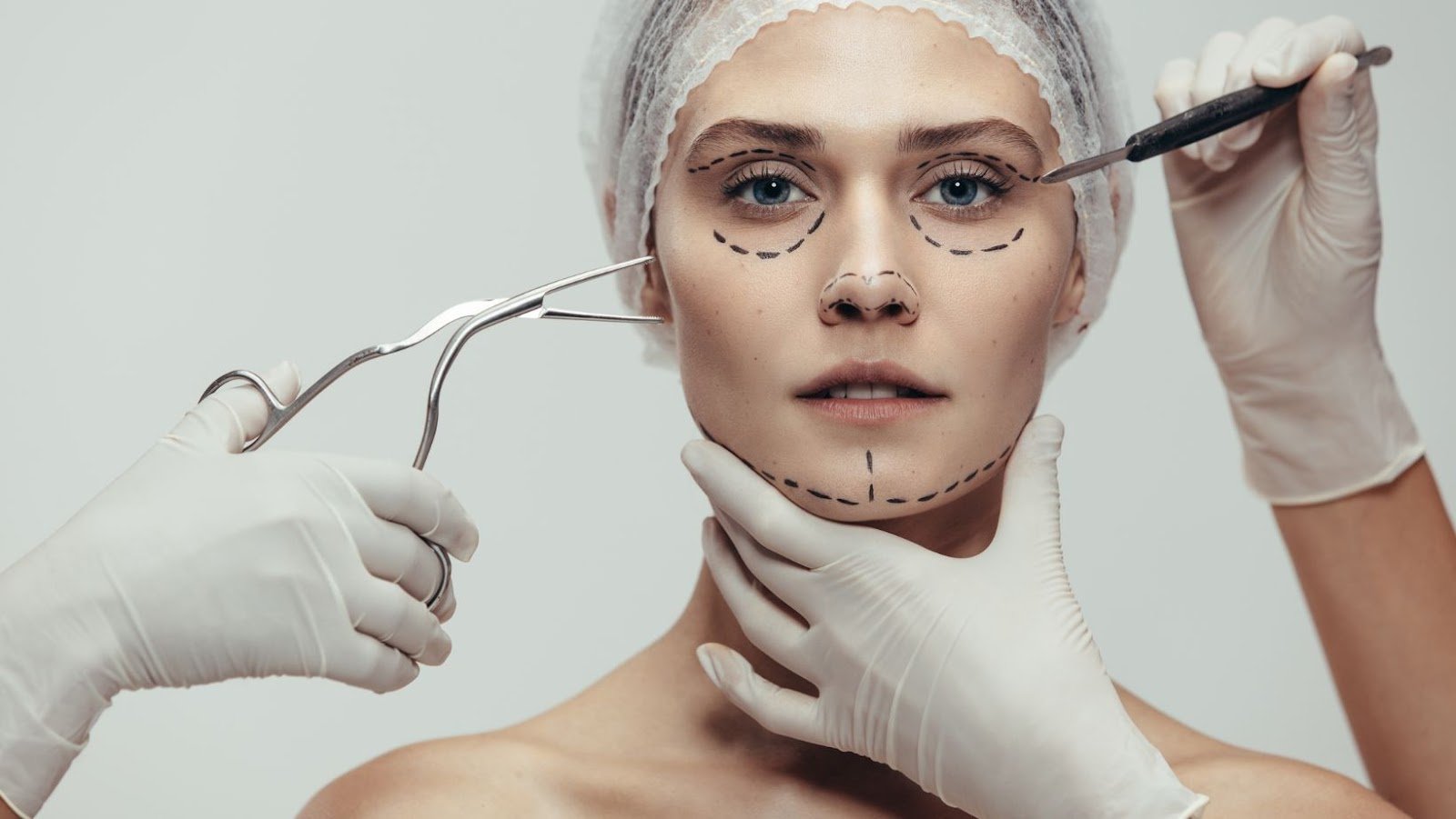 3 Types of Facial Implants You Should Know About