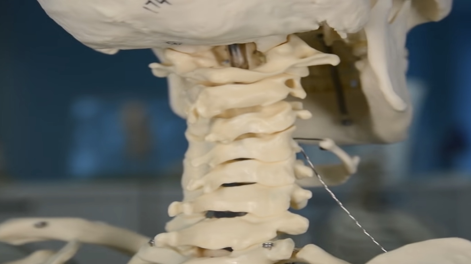name the vertebral projection oriented in a median plane