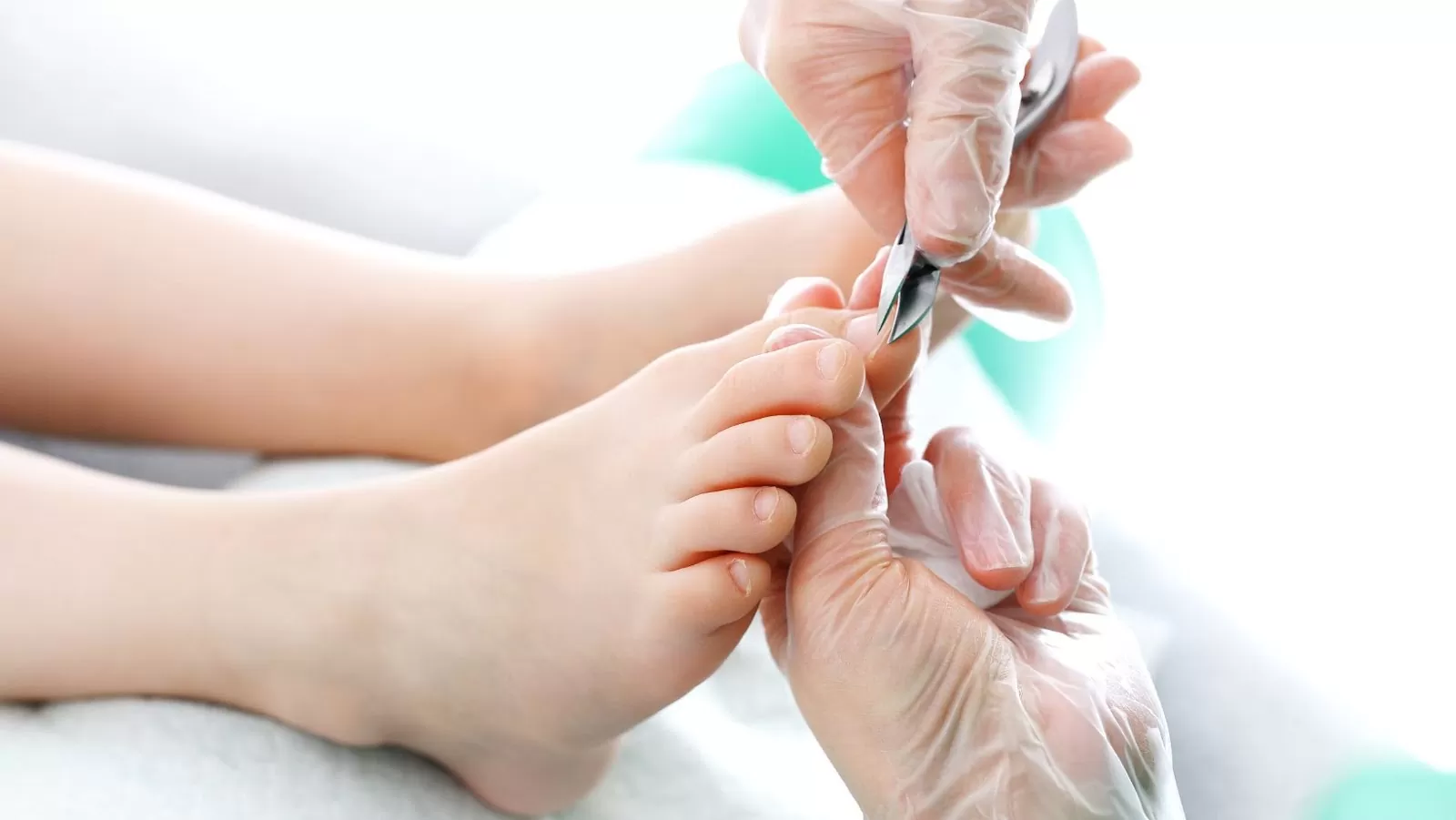Ingrown Toenails, Prevention, and Treatment Options