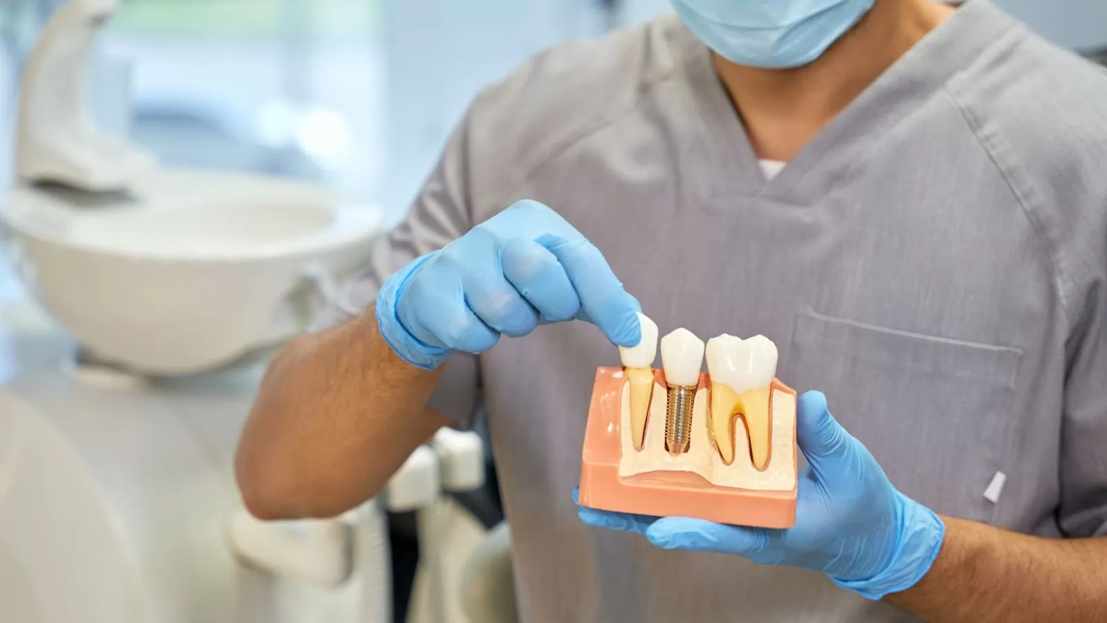 Everything You Need to Know Before Having Dental Implants